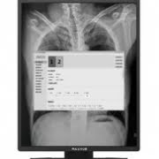 img_medical_display_6